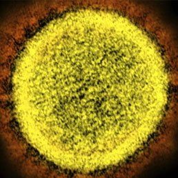 Doctors Studying Why Obesity May Be Tied To Serious COVID-19